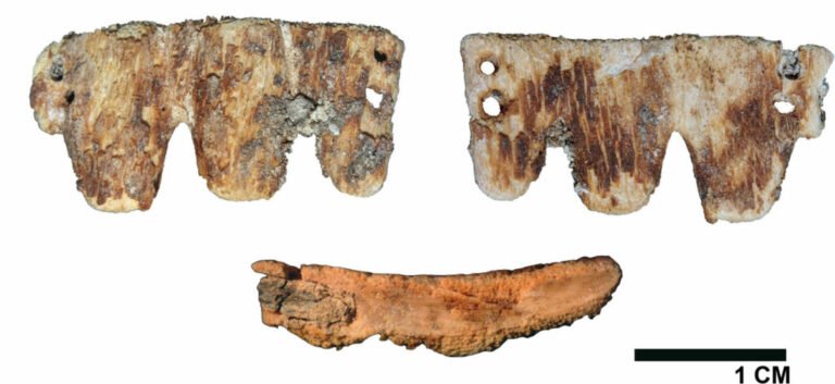 Macro stereomicroscopic images of dental bridges