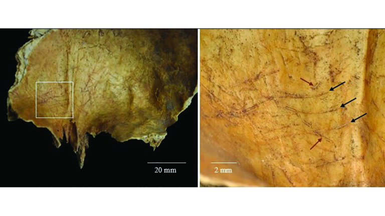 on the left, a photo of the inside of a human skull with scratch marks; on the right, a closeup showing the marks