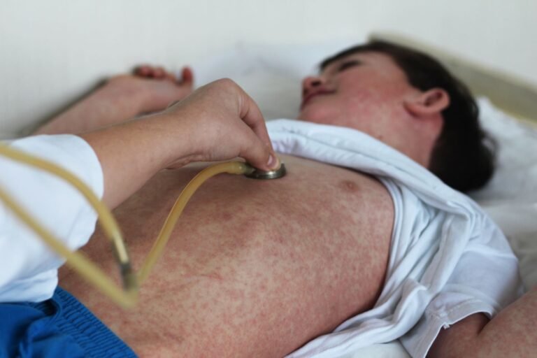 doctor places stethoscope on the chest of a young child with measles